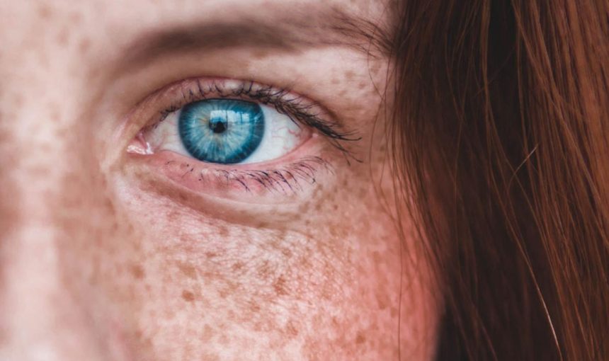 9 makeup tips to highlight your freckles